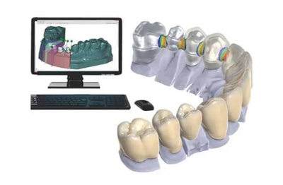 Преимущества CAD/CAM технологии в стоматологии
