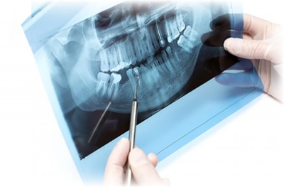 Преимущества Цифровой 3D Рентген-диагностики в Украине в 2023 году